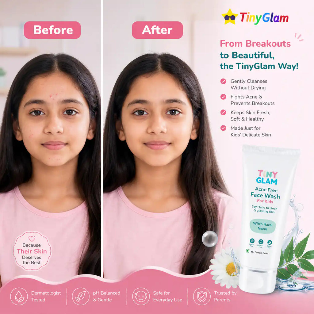 TinyGlam Acne Free Face Wash