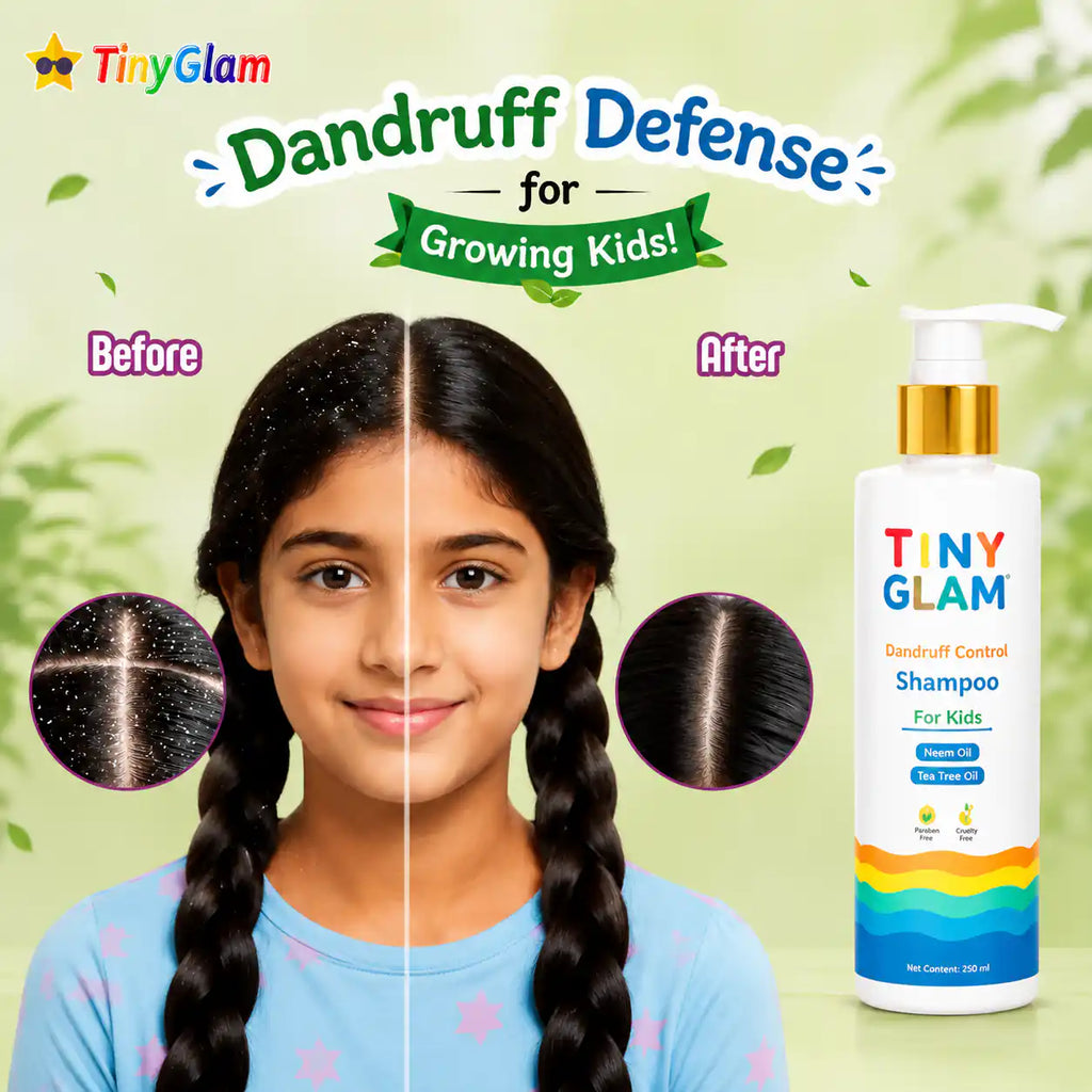 TinyGlam Dandruff Relief Shampoo
